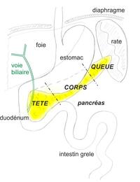 cancer du pancrea